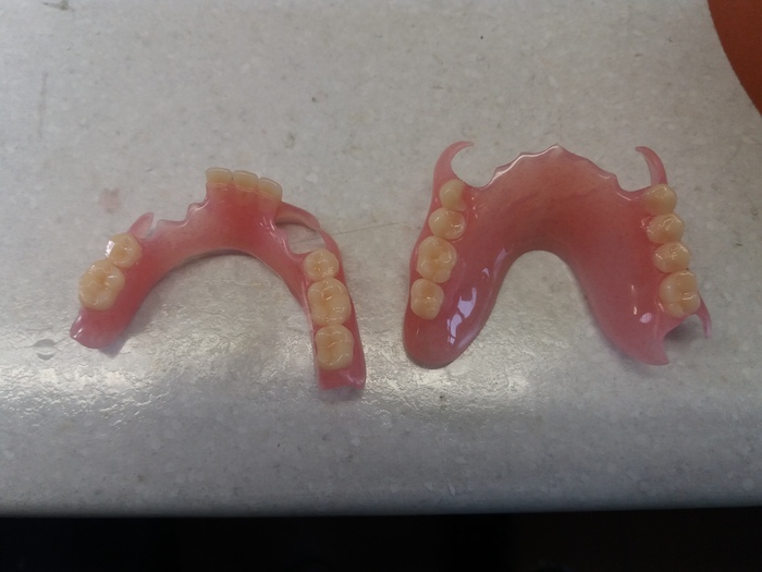 Виготовлення нейлонових протезів. Матеріал Vertex T10 / TTRV напівжорсткий. Гарантія на протези - 1 рік. Zooble.com.ua