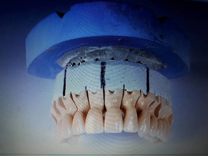 Зуботехнічна лабораторія запрошує до співпраці лікарів стоматологів та стомат. кабінети. Одна одиниця МК - 500 грн. Zooble.com.ua