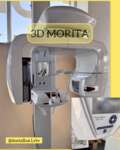 Томограф Veraviewepocs 3D R100 (модель X550) Виробник Японія Morita. 3D КТ (CBCT) знімків щелепно-лицевої ділянки Zooble.com.ua