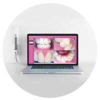 Нова італійська інтраоральна камера MyRay CU2 HD знижка 200€ Zooble.com.ua