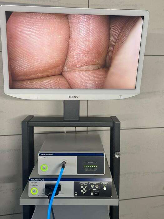 1. Відеосистема Full HD , Olympus 190 2.Монітор Sony 27 дюймів 3.Джерело світла LED CLL-1 Разом : 11 000 є Zooble.com.ua