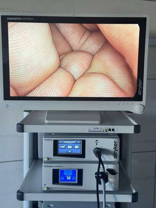 1. Відеосистема Full HD , Stryker 1588 2.Монітор Visionpro Led 26 дюймів 3. Джерело світла StrykerL9000 Zooble.com.ua