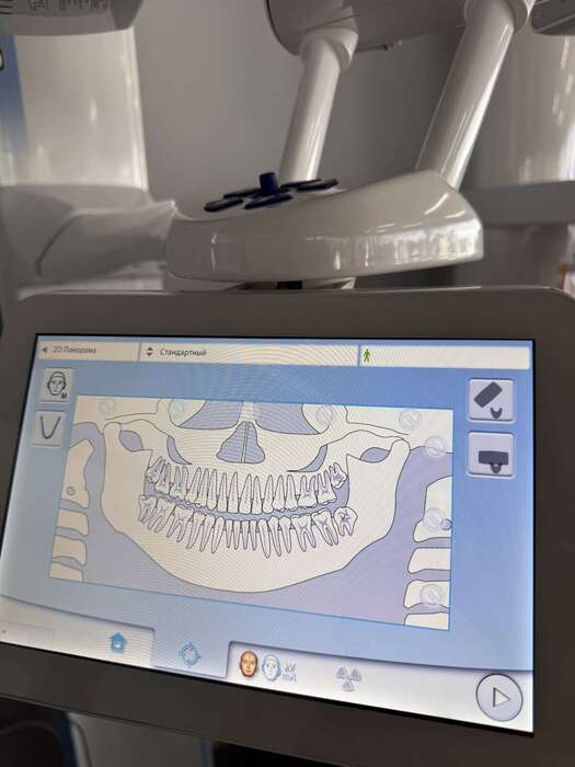 3D томограф Planmeca ProMax 3D Mid – сучасна система для високоточних діагностичних досліджень Виробник Фінляндія Zooble.com.ua