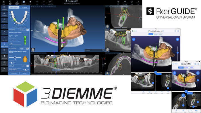 Продам системний блок з установленою програмою для візуалізації та виготовлення шаблонів 3DIEMME 3diagnosys + plasticad Zooble.com.ua