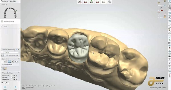 3shape 2020 (Implant studio / Ortho studio / Dental Design / Trios Design Studio)БУ Цена ниже рыночной!!! Zooble.com.ua