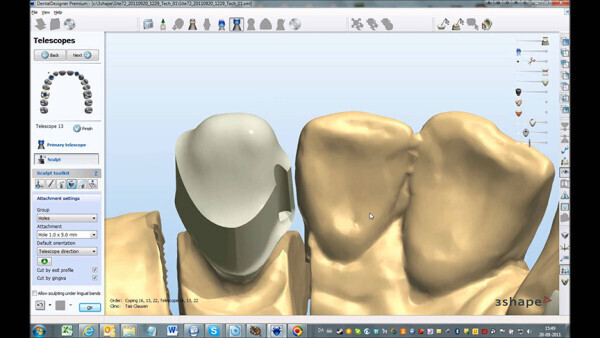 3shape 2020 (Implant studio / Ortho studio / Dental Design / Trios Design Studio)БУ Цена ниже рыночной!!! Zooble.com.ua