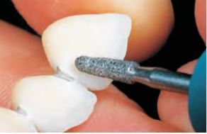 Алмазные боры зубным техникам под прямой наконечник в ассортименте Dent, Lixin, Dian. Каталоги здесь www.0966304669.com Zooble.com.ua