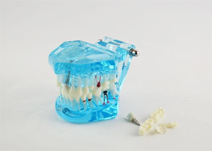 Демонстрационная модель зубов съемные зубы Zooble.com.ua