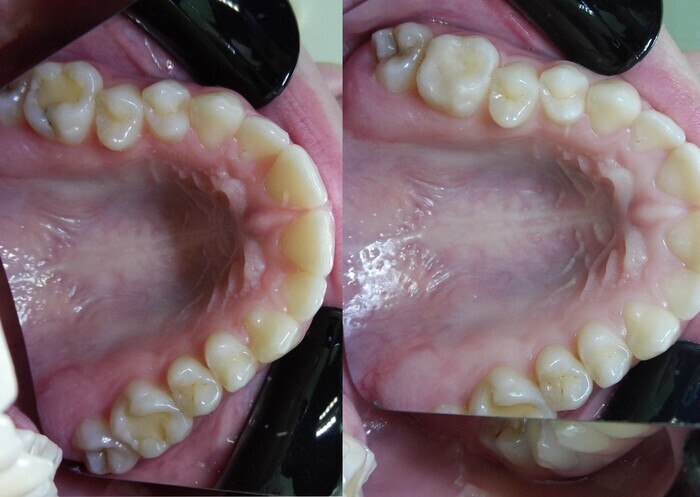 Дентальне фото апарат з підсвіткою дзеркал та обдувом повітря (4 дзеркала з полірованої сталі високої якості) Zooble.com.ua