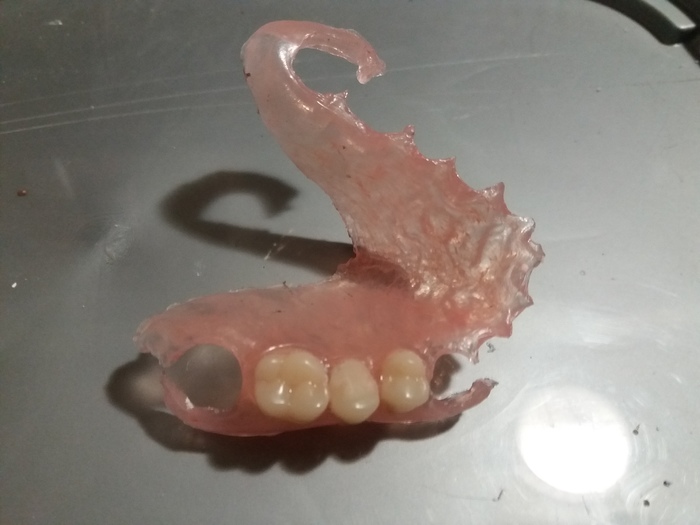 Для зуных Техников!!!! Литье (инжекция) нейлоновых съемных зубных протезов `Deflex`, `Vertex`.Срок изготовление 1-3 дня. Zooble.com.ua