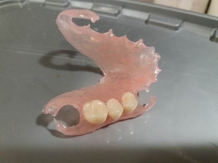 Для зуных Техников!!!! Литье (инжекция) нейлоновых съемных зубных протезов `Deflex`, `Vertex`.Срок изготовление 1-3 дня. Zooble.com.ua