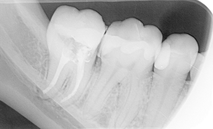 Durr dental vistascan plus Сканер пластин/ визиограф Прицiльнi знiмки +панорамнi.. . В наявності Zooble.com.ua