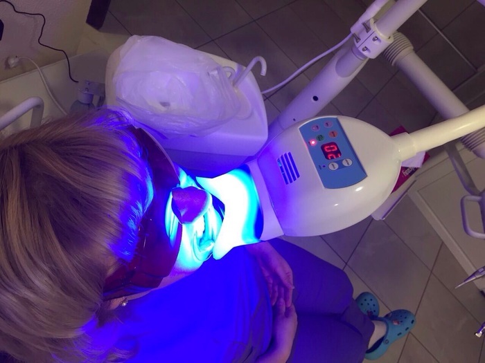 Фотополимерная лампа для отбеливания с креплением Zooble.com.ua