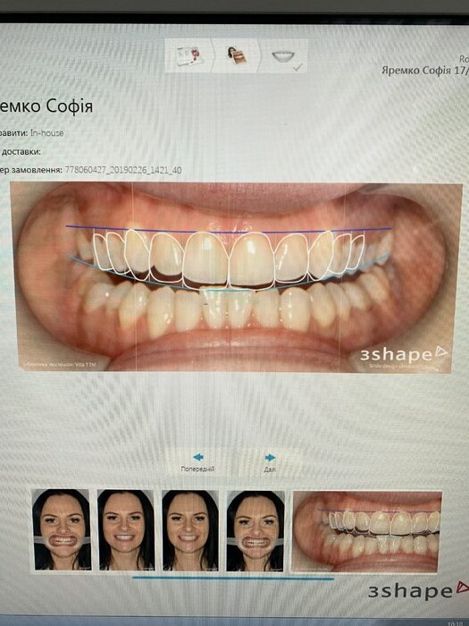 Інтраоральний сканер 3 Shape Trios 3 Cart Top Продається мрія сучасного стоматолога. Zooble.com.ua