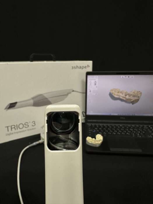 Інтраоральний сканер 3 Shape Trios 3 Провідний В комплекті насадки і калібровочний набір Стан - ідеальний Ціна - 6500€ Zooble.com.ua