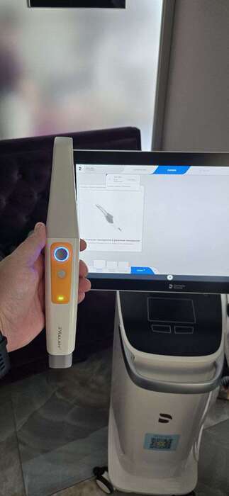 Інтраоральний сканер joyscan 11 дротовий та бездротовий на складі! Zooble.com.ua