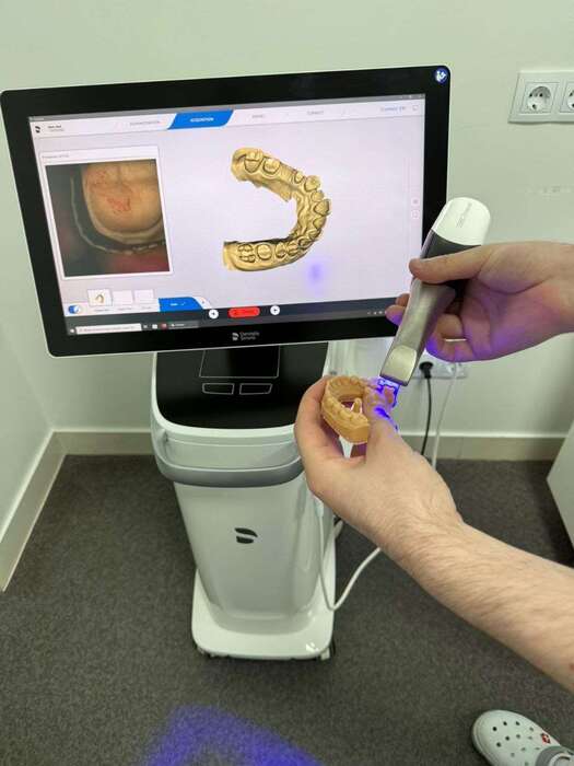 Інтраоральнтй сканер Densply Sirona Primescan 19 рік(привезений з Німеччини) ідеальний стан! Zooble.com.ua