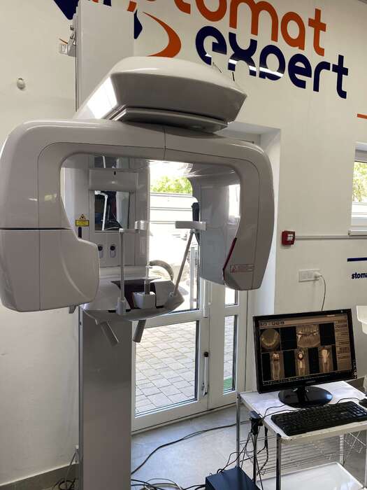 Комп ютерний Томограф J. Morita Veraviewepocs X550 3D ВиробникЯпонія Рамка 8*8 Стан - вживаний В комплекті комп ютер Zooble.com.ua