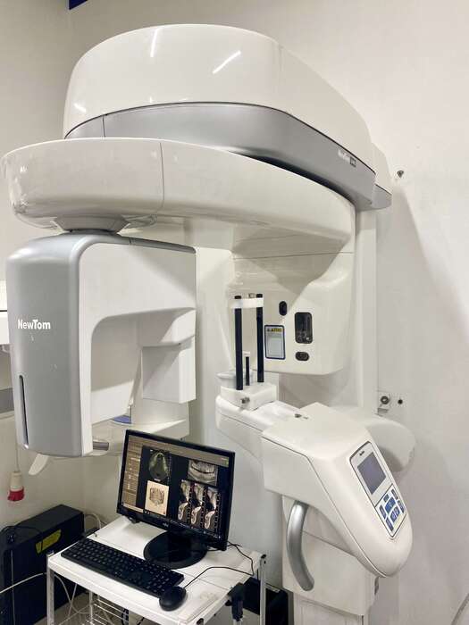 Комп ютерний томограф NewTom Giano Виробник - Італія Рамка 11*8 В комплекті з ПЗ та комп ютером Стан - відмінний Zooble.com.ua