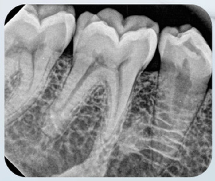 Комплект для рентгендіагностики E-Ray+E-sensor Size1 гарантія рік , свій інтерес ! Якісна та надійна підтримка 24/7! Zooble.com.ua