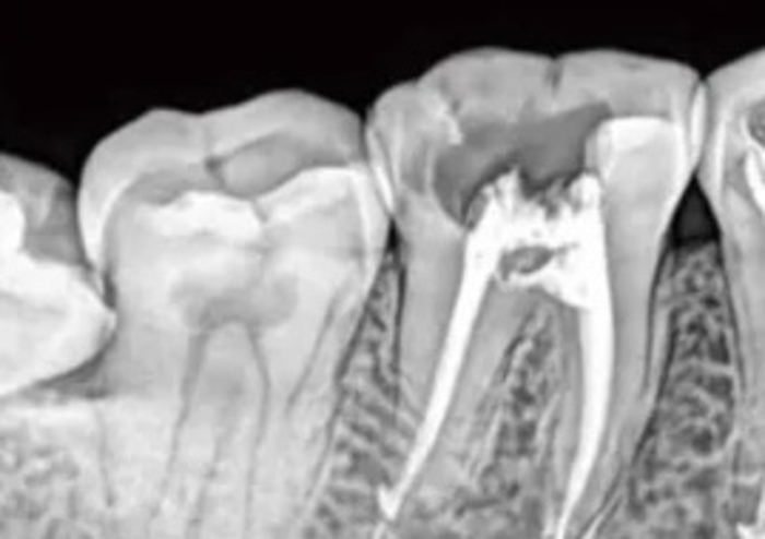 Комплект Xpect Vision: Поративний рентген плюс візіограф з позиціонером з підрахунком фотонів Size1/Size2 на складі! Zooble.com.ua