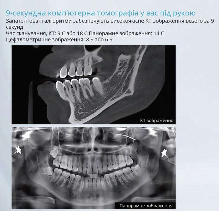 Комп`ютерний томограф 2 в 1 FinScan F350 від Eighteeth Zooble.com.ua