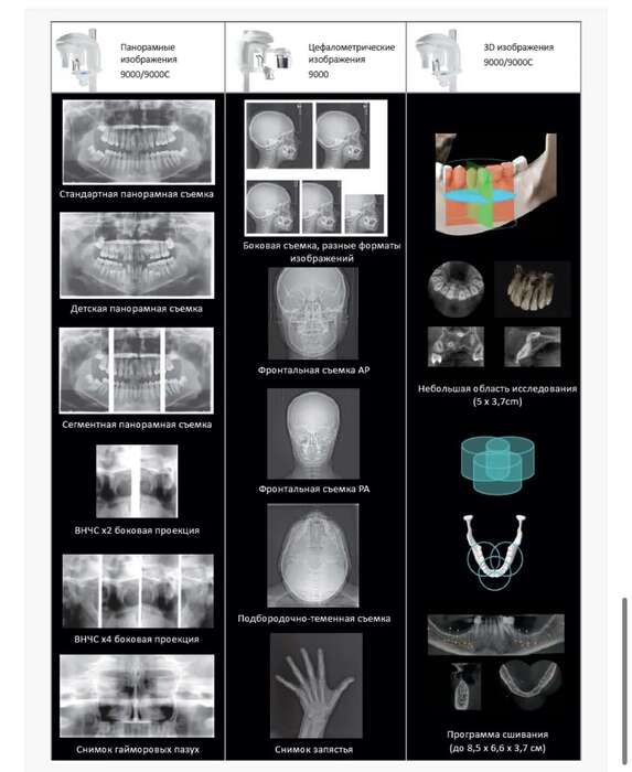 Компютерний томограф Carestream CS9000 3D Carestream Dental CS 9000 3D - цифровий дентальний томограф, 2 в 1 Zooble.com.ua