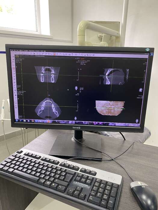 Компютерний томограф фірми E-Woo( Vatech) Рамка захвата 12,5*8,5 Є функція панорами. З програмним забезпеченням Zooble.com.ua