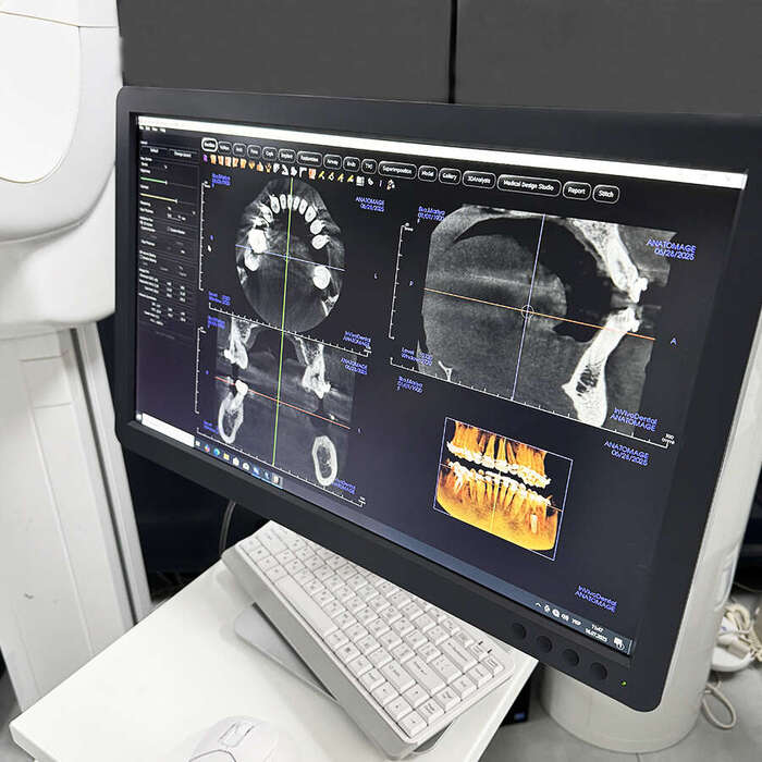 Комп`ютерний Томограф Gendex GXDP-700 2D/3D|2014рік|6x8|VM-Dental2016 Zooble.com.ua