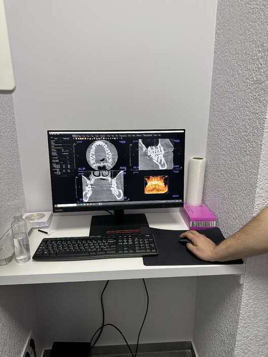 Комп`ютерний Томограф Gendex GXDP-700 2D/3D Можна подивитися в кабінеті в Полтаві! Zooble.com.ua