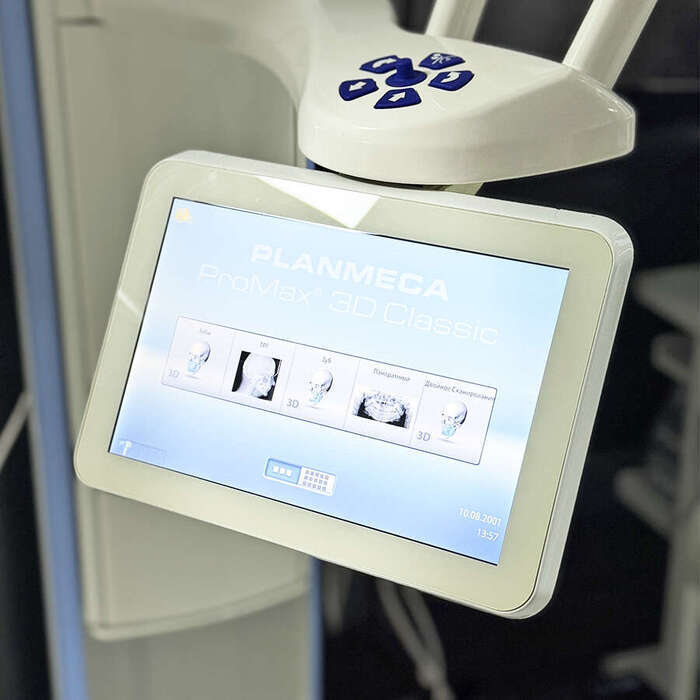 Комп`ютерний томограф Planmeca ProMax 3D Classic з цефалостатом |2015р.|11x8|VM-Dental 2016| Zooble.com.ua