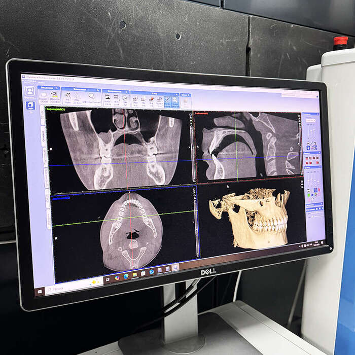 Комп`ютерний Томограф Planmeca ProMax3D Mid |VM-Dental 2016 Zooble.com.ua