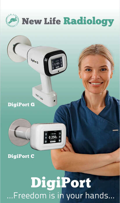New! Рентген New Life Radiology(Італія) у вигляді фотіка та пістолету DigiPort C/DigiPort G Під замовлення,ціну уточнюй Zooble.com.ua