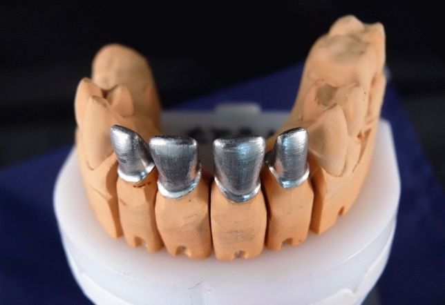 Новая стоматологическая литейка предлагает свои услуги по изготовлению литья, под металлокерамику, металлопластмасу Zooble.com.ua