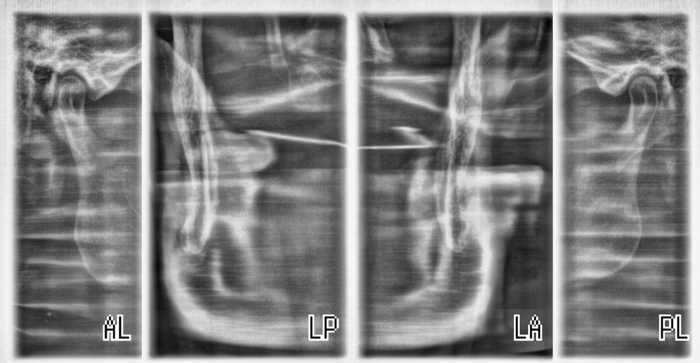 Панорамний рентген Planmeca ProONE 2017 рік. 773 знімка. Zooble.com.ua