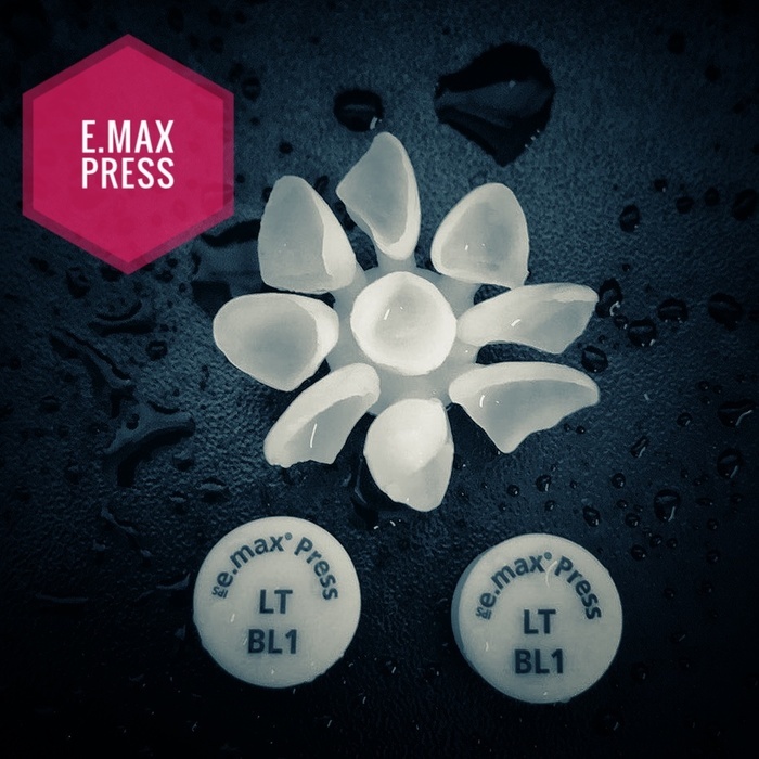 Пресс керамика,E.max press,emax Zooble.com.ua