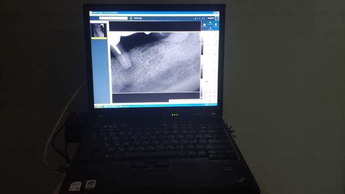 Прицільний рентген TROPHY з візіографом. БУ В ідеальному робочому стані. Zooble.com.ua