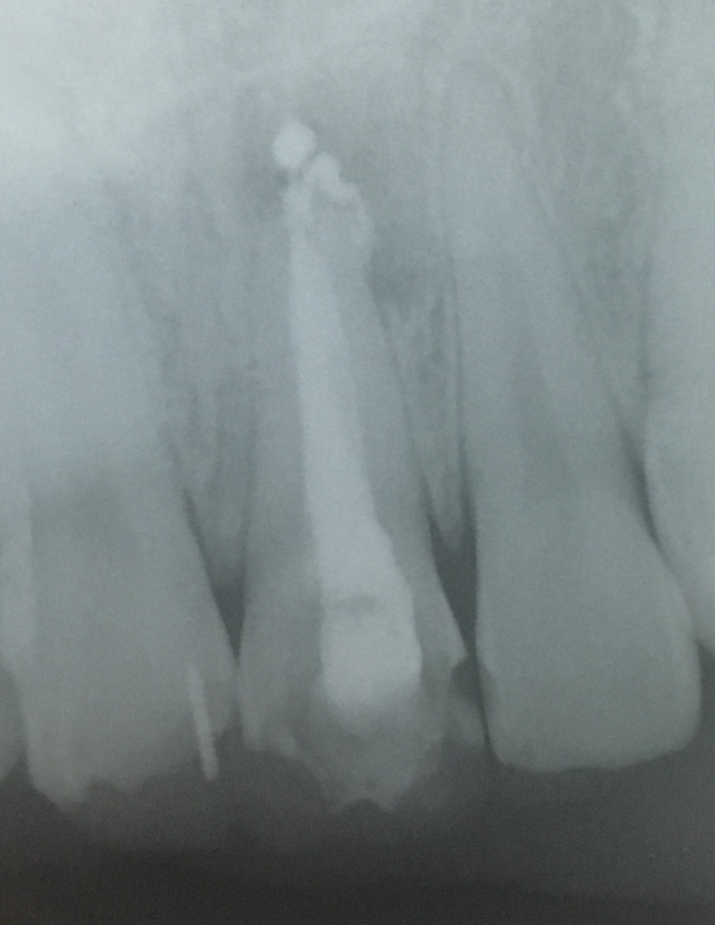 Прицільний RTG Gendex Oralix 65 Zooble.com.ua