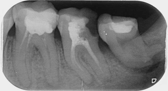 Продам рентген SIMENS SIRONA HELIODENT 70 БУ. Рабочий, образцы снимков приложены. Zooble.com.ua