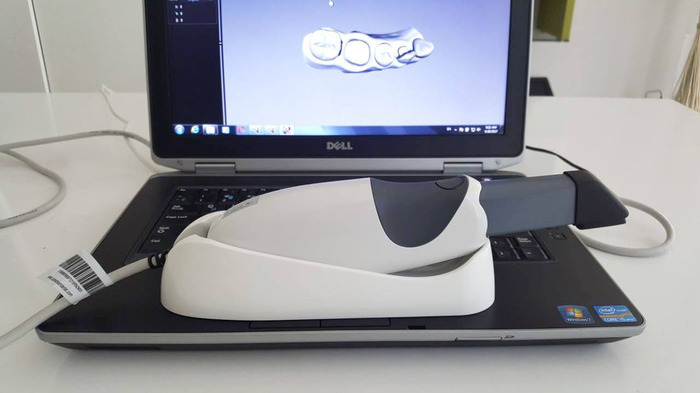 Продам стоматологический интраоральный 3D сканер CS 3500 с ноутбуком. Zooble.com.ua
