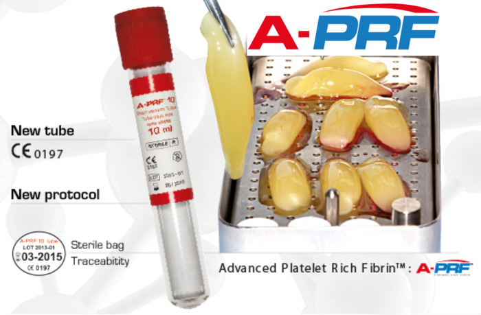 Протокол A-PRF (методика и техника получения сгустков A-PRF для применения в хирургии, имплантации, травматологии) Zooble.com.ua