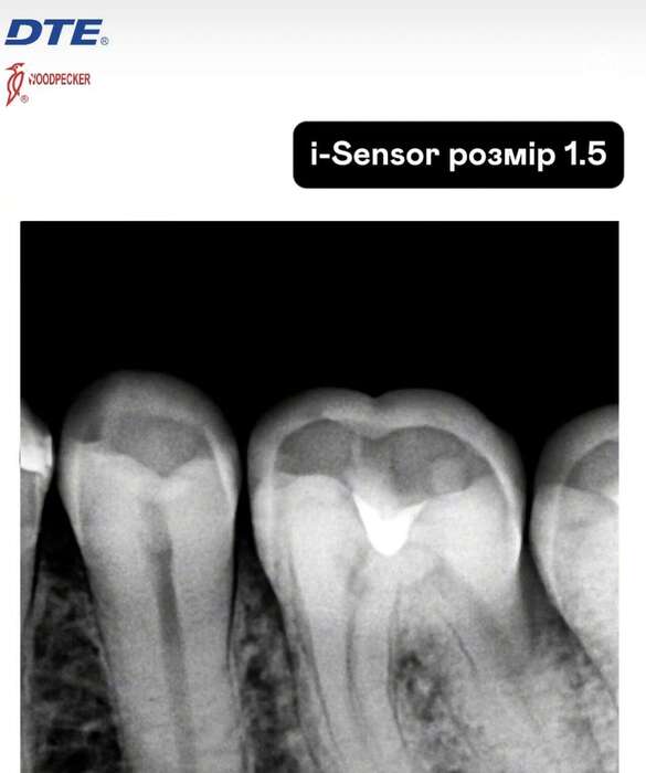 Радіовізіограф Woodpecker Н1.5 ! В наявності! Розмір середній для змішаного прийому! АКЦІЙНА ПРОПОЗИЦІЯ Є РЕЄСТРАЦІЯ!!! Zooble.com.ua