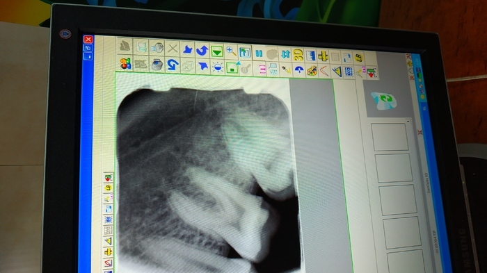 Ренген Сканер , візіограф, деталі по телефону Zooble.com.ua