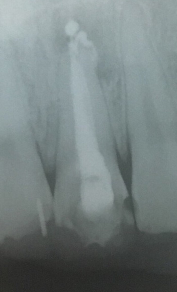 Рентген-апарат прицільний Belmont Japan В наявності Zooble.com.ua