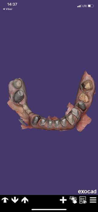 Сканер Medit i500 стан ідеальний всі деталі по телефон Zooble.com.ua