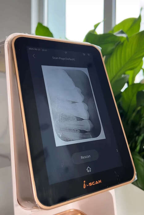 Сканер пластин i-Scan Woodpecker на складі(бездротовий візіограф) зручність та комфорт як для пацієнта так і для лікаря! Zooble.com.ua