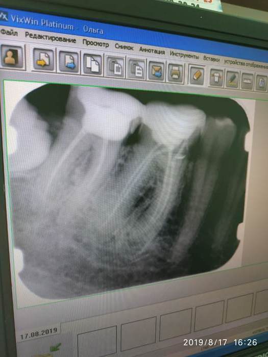 Сканер ренген пластин Візіограф Zooble.com.ua