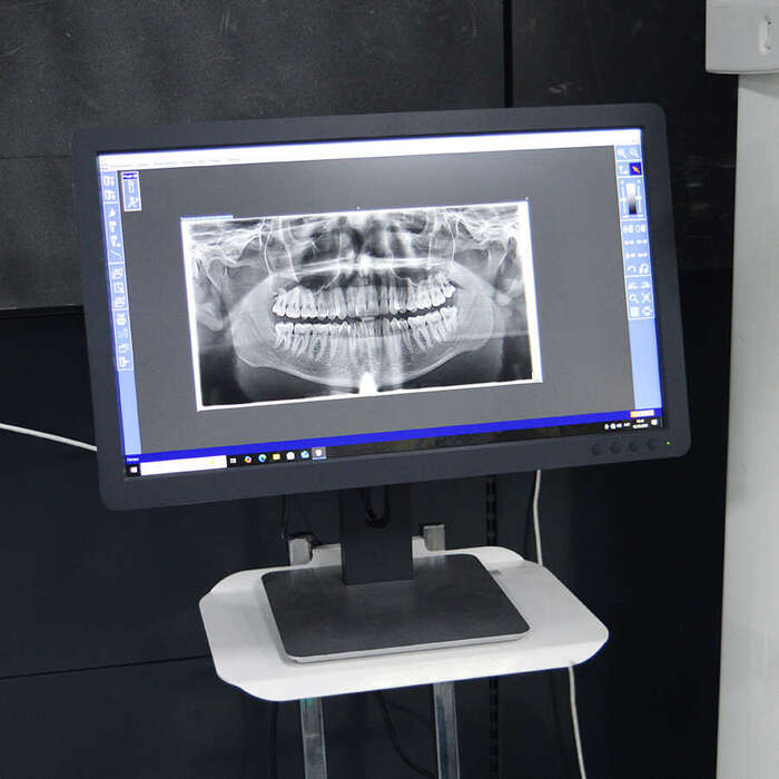 Стоматологічний панорамний рентген 2D Sirona Orthophos XG Zooble.com.ua