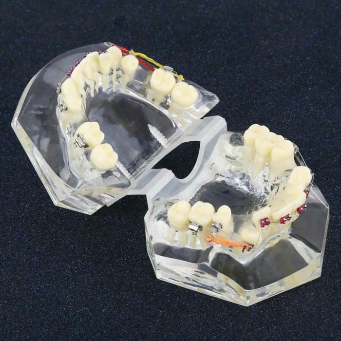 Стоматологічно-ортодонтична демонстраційна модель! Абсолютно нова! Zooble.com.ua