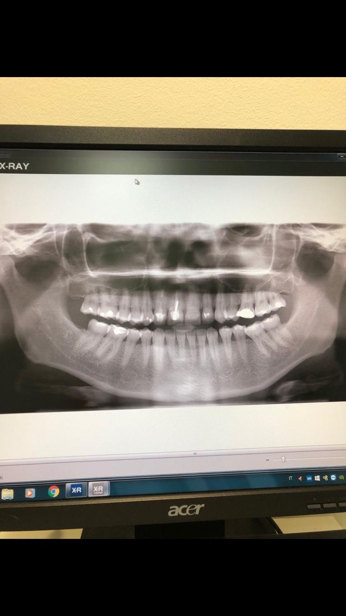 Цифровий 2D ортопонтомограф Кодак 8000 С Zooble.com.ua